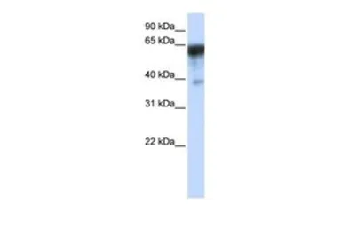 Anti-KIRREL antibody, Internal used in Western Blot (WB). GTX46299