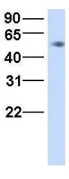 Anti-HHAT antibody, N-term used in Western Blot (WB). GTX46303