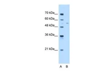 Anti-MLSTD1 antibody, C-term used in Western Blot (WB). GTX46305
