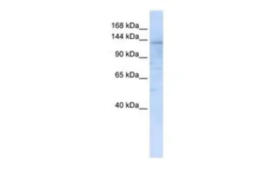 Anti-IMPG2 antibody, C-term used in Western Blot (WB). GTX46342