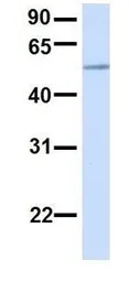 Anti-PIGT antibody, C-term used in Western Blot (WB). GTX46349