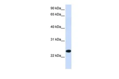 Anti-PILRB antibody, Internal used in Western Blot (WB). GTX46383