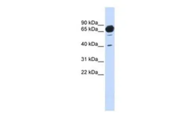 Anti-MAN1A2 antibody, Internal used in Western Blot (WB). GTX46405