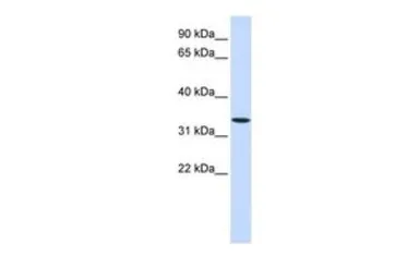 Anti-Wnt6 antibody, Internal used in Western Blot (WB). GTX46413