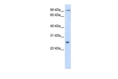 Anti-TSPAN31 antibody, Internal used in Western Blot (WB). GTX46417