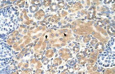 Anti-TSPAN5 antibody, Internal used in IHC (Paraffin sections) (IHC-P). GTX46421