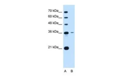 Anti-TSPAN5 antibody, Internal used in Western Blot (WB). GTX46421