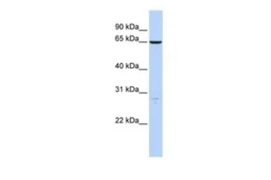 Anti-HAS3 antibody, N-term used in Western Blot (WB). GTX46425