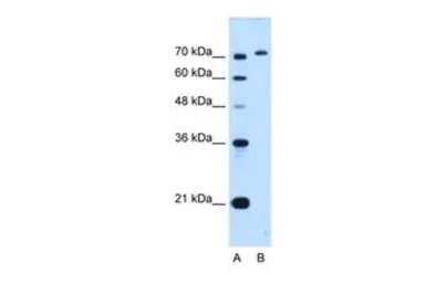 Anti-GPAA1 antibody, C-term used in Western Blot (WB). GTX46455