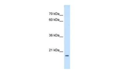 Anti-ASF1B antibody, Internal used in Western Blot (WB). GTX46463