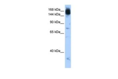 Anti-NCAPD2 antibody, C-term used in Western Blot (WB). GTX46473