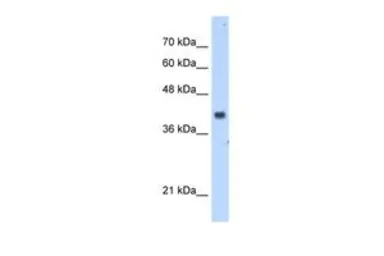 Anti-PDSS1 antibody, Internal used in Western Blot (WB). GTX46475