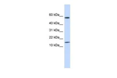 Anti-KRTAP11-1 antibody, N-term used in Western Blot (WB). GTX46505