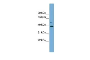 Anti-C21orf58 antibody, N-term used in Western Blot (WB). GTX46510