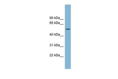 Anti-CHST1 antibody, Internal used in Western Blot (WB). GTX46545
