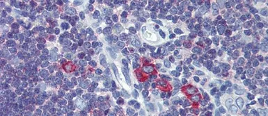 Anti-TFR2 antibody, Internal used in IHC (Paraffin sections) (IHC-P). GTX46552