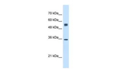 Anti-TRAP alpha antibody, N-term used in Western Blot (WB). GTX46556