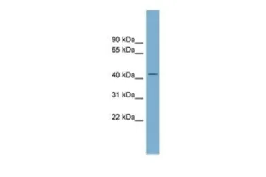 Anti-COX10 antibody, Internal used in Western Blot (WB). GTX46575