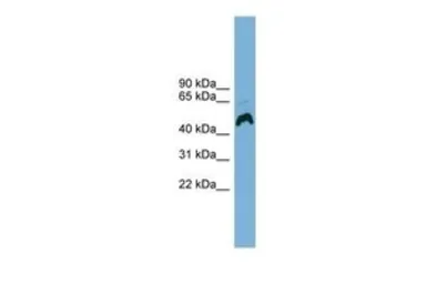 Anti-ATP6AP1 antibody, Internal used in Western Blot (WB). GTX46577