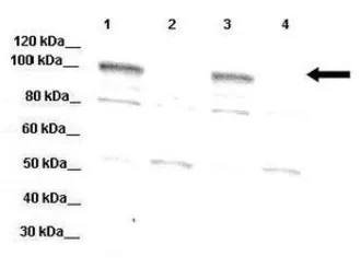 Anti-DPP6 antibody, Internal used in Western Blot (WB). GTX46610