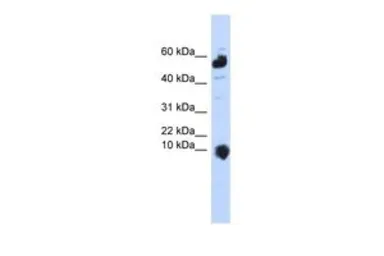 Anti-C1ORF151 antibody, Internal used in Western Blot (WB). GTX46630
