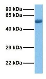 Anti-MARVELD3 antibody, Internal used in Western Blot (WB). GTX46649