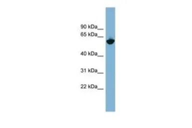 Anti-GPNMB antibody, N-term used in Western Blot (WB). GTX46705