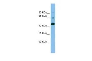 Anti-TMEM195 antibody, Internal used in Western Blot (WB). GTX46713