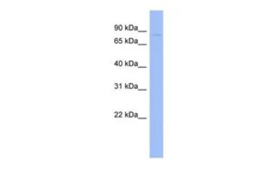 Anti-GPD2 antibody, N-term used in Western Blot (WB). GTX46745