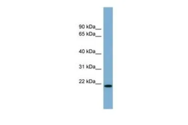 Anti-p22phox antibody, Internal used in Western Blot (WB). GTX46749