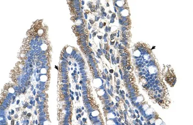 Anti-SLC25A39 antibody, C-term used in IHC (Paraffin sections) (IHC-P). GTX46814