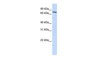 Anti-SLCO2B1 antibody, N-term used in Western Blot (WB). GTX46821