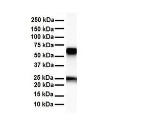 Anti-SLC33A1 antibody, Internal used in Western Blot (WB). GTX46828