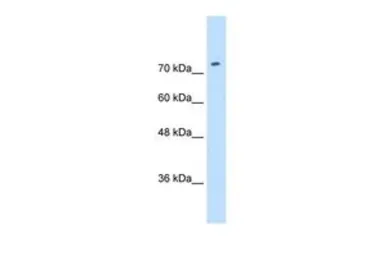 Anti-SLC7A1 antibody, N-term used in Western Blot (WB). GTX46841