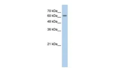Anti-SLC38A1 antibody, Internal used in Western Blot (WB). GTX46848
