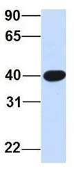 Anti-SNTB1 antibody, N-term used in Western Blot (WB). GTX46866