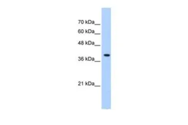 Anti-PEX10 antibody, Internal used in Western Blot (WB). GTX46881