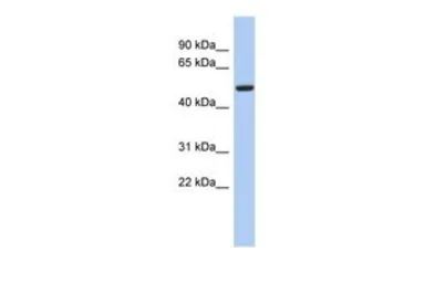 Anti-FBXO3 antibody, N-term used in Western Blot (WB). GTX46928