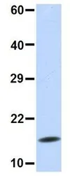 Anti-UBE2D3 antibody, N-term used in Western Blot (WB). GTX46939