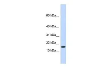 Anti-HERC4 antibody, N-term used in Western Blot (WB). GTX46941