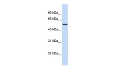 Anti-GTPBP10 antibody, Internal used in Western Blot (WB). GTX46948