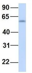 Anti-GTPBP2 antibody, N-term used in Western Blot (WB). GTX46998