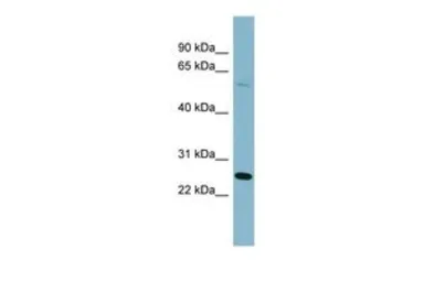Anti-QRSL1 antibody, N-term used in Western Blot (WB). GTX47004