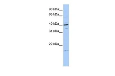 Anti-TPPP3 antibody, Internal used in Western Blot (WB). GTX47020