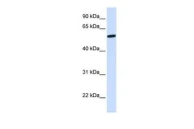 Anti-NELF antibody, N-term used in Western Blot (WB). GTX47024