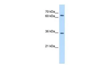 Anti-PPP2R3B antibody, C-term used in Western Blot (WB). GTX47037