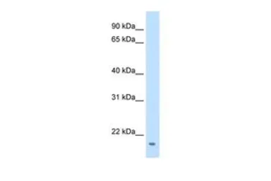 Anti-FAM107A antibody, Internal used in Western Blot (WB). GTX47042