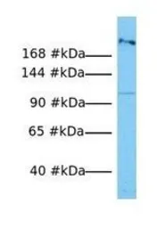 Anti-MYH1 antibody, N-term used in Western Blot (WB). GTX47052