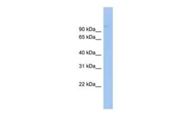 Anti-ABCB6 antibody, Internal used in Western Blot (WB). GTX47055