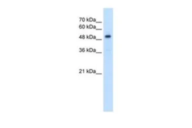 Anti-SLC1A5 antibody, Internal used in Western Blot (WB). GTX47058